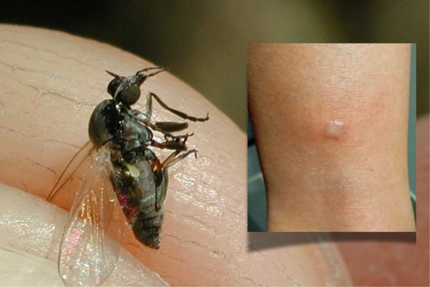 La simulie, cette petite mouche qui provoque de vilaines inflammations et démangeaisons.